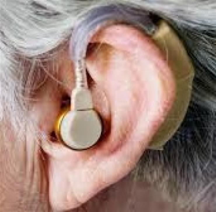 Hearing aids may help in fight against dementia Lancet