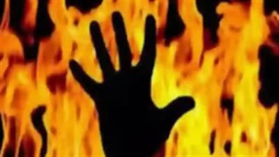 UP: Groom, two others sustain burn injuries before wedding