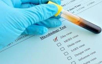 K'taka on alert as first case of Zika virus surfaces